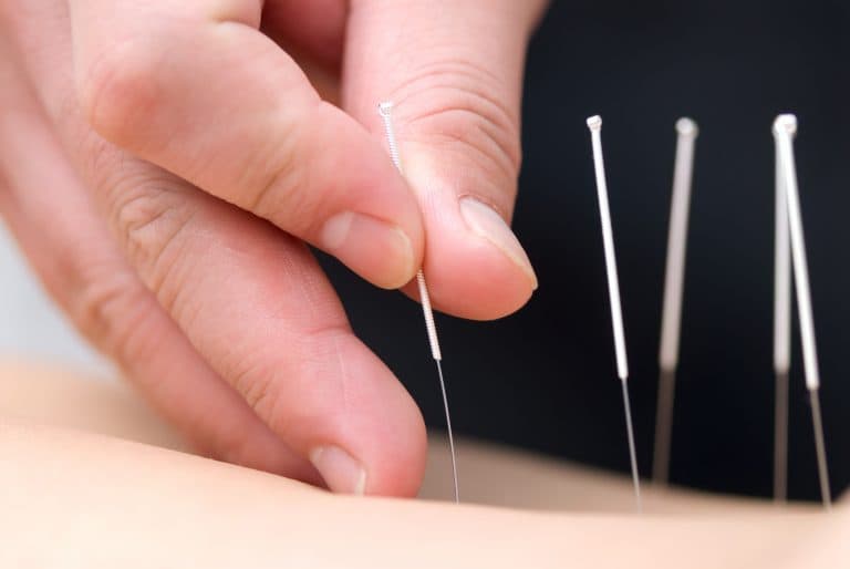 We provide dry needling and acupuncture.